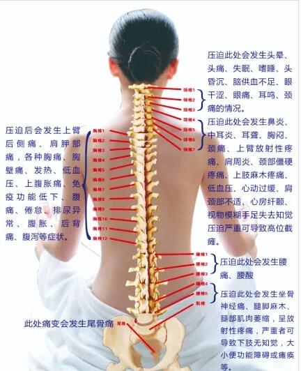 保護(hù)腰椎—示范腰椎保健操，趕快收藏吧
