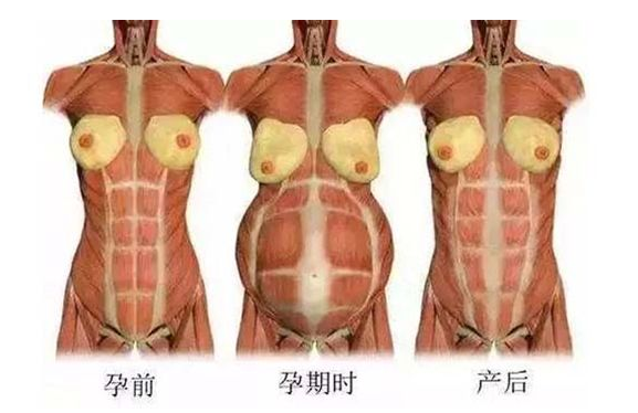 產(chǎn)后媽媽骨盆修復(fù)――帶你回到完美身材！