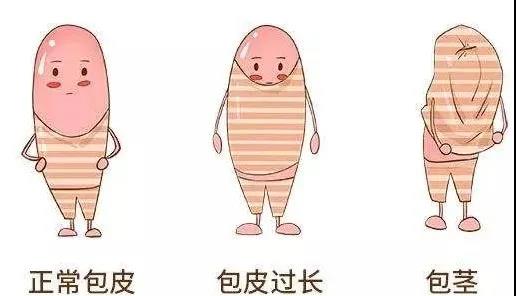 【保山安利醫(yī)院】家長(zhǎng)速看！暑期包皮手術(shù)預(yù)約正當(dāng)時(shí)！
