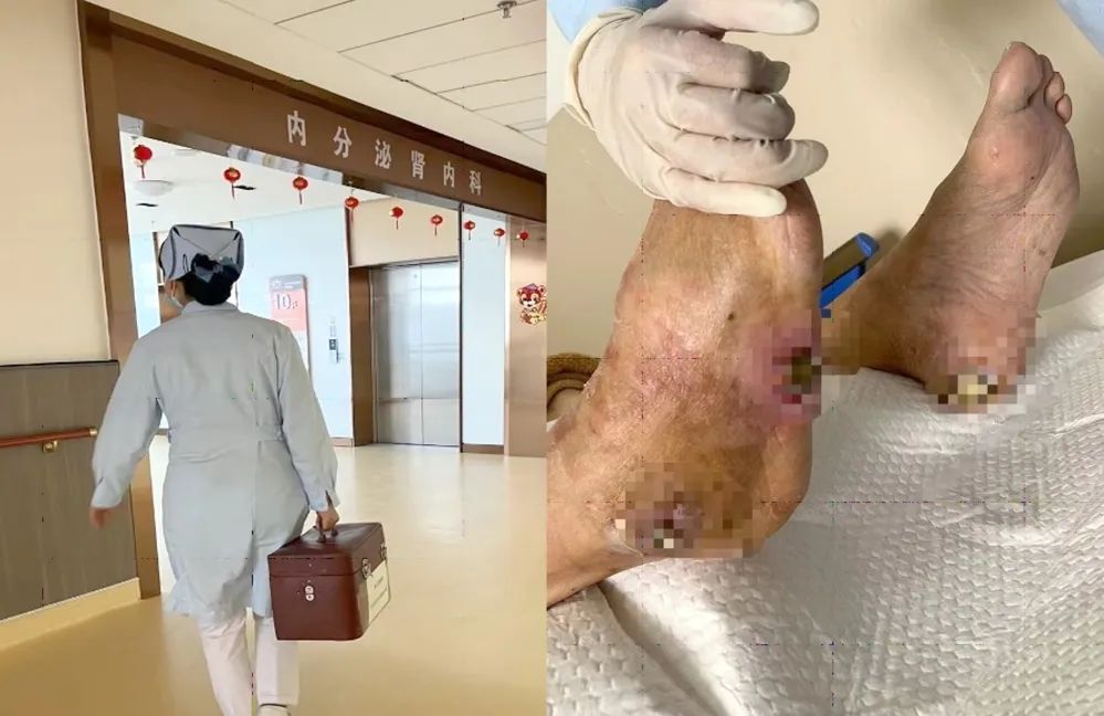 【保山安利醫(yī)院】傷口治療一站式，健康生活零距離！